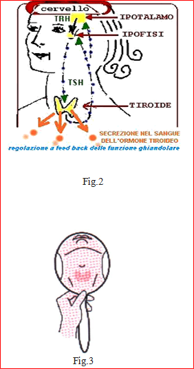 FIG2 3